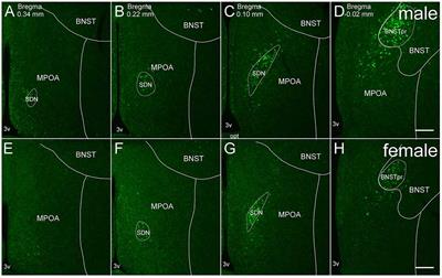 Moxd1 Is a Marker for Sexual Dimorphism in the Medial Preoptic Area, Bed Nucleus of the Stria Terminalis and Medial Amygdala